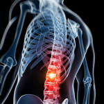 Regional Trademark Owner Can't Block Junior User's Internet Presence--Dudley v. HealthSource (Catch-up Post)